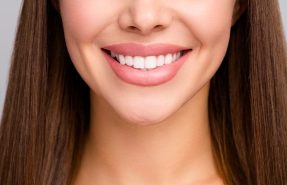 Hollywood Smile Nedir?