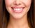 Hollywood Smile Nedir?