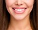 Hollywood Smile Nedir?