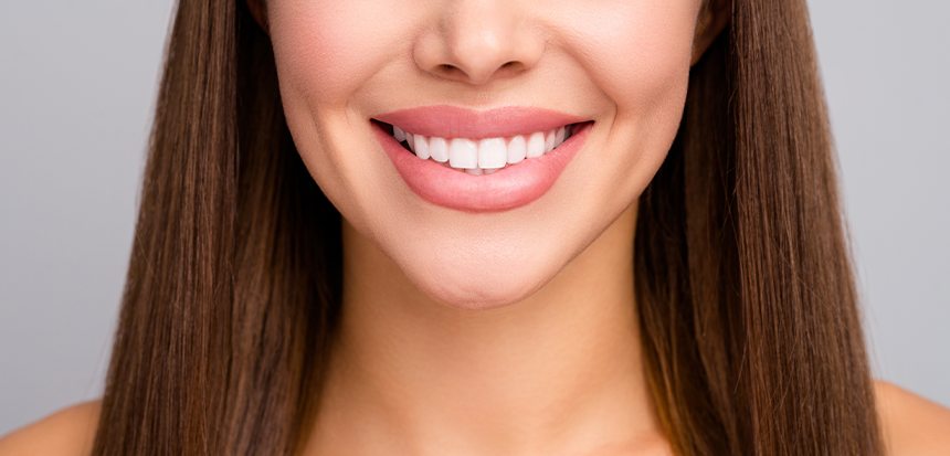 Hollywood Smile Nedir?