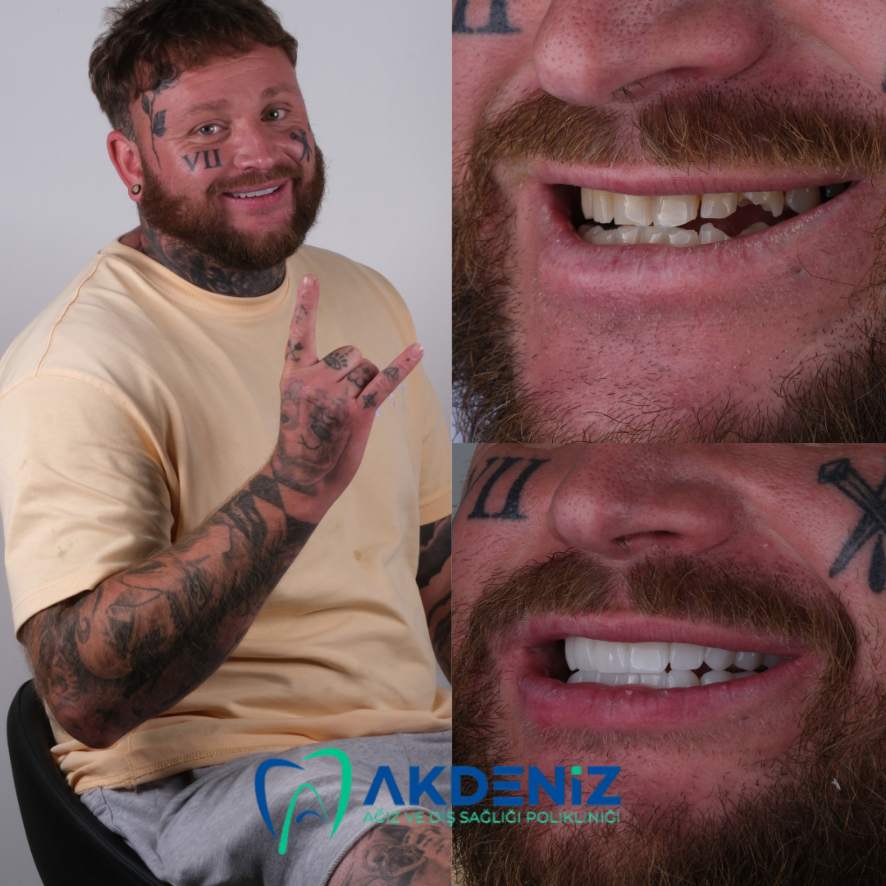 2-1