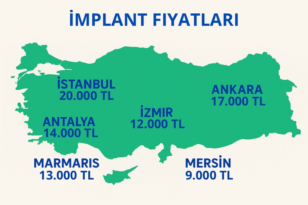 İmplant Fiyatları